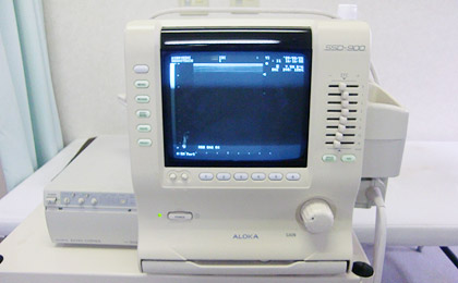 エコー（超音波）